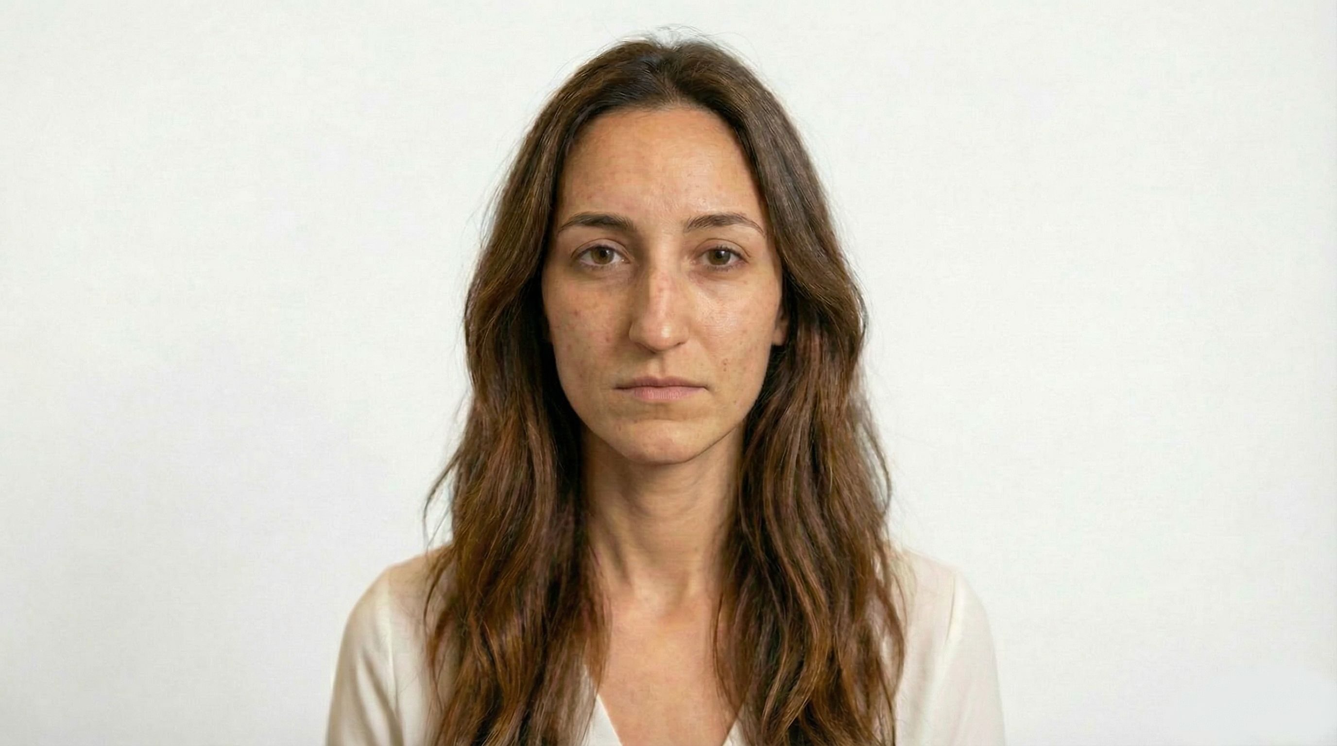 Antes del tratamiento